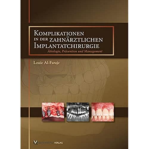 Komplikationen in der zahnärztlichen Implantatchirurgie: Ätiologie, Prävention und Management Komplikationen in der zahnärztlichen Implantatchirurgie: Ätiologie, Prävention und Management