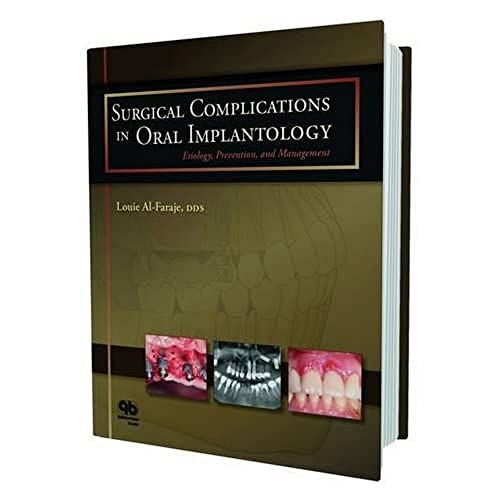 Surgical Complications in Oral Implantology: Etiology, Prevention, and Management von Quintessence Publishing (IL)