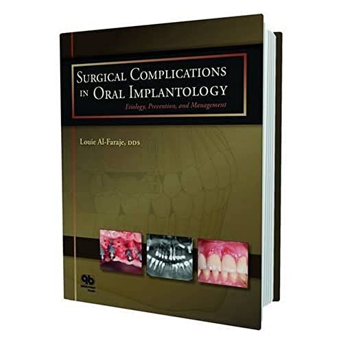 Surgical Complications in Oral Implantology: Etiology, Prevention, and Management