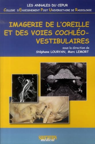 IMAGERIE DE L'OREILLE ET DES VOIES COCHLEO-VESTIBULAIRES - ANNALES DU CEPUR