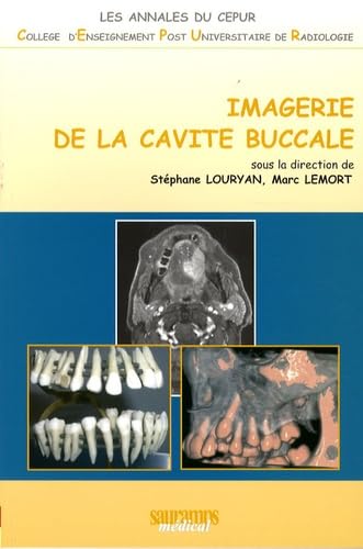 IMAGERIE DE LA CAVITE BUCCALE von SAURAMPS MEDICA
