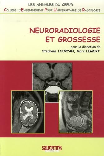 NEURORADIOLOGIE ET GROSSESSE von SAURAMPS MEDICA