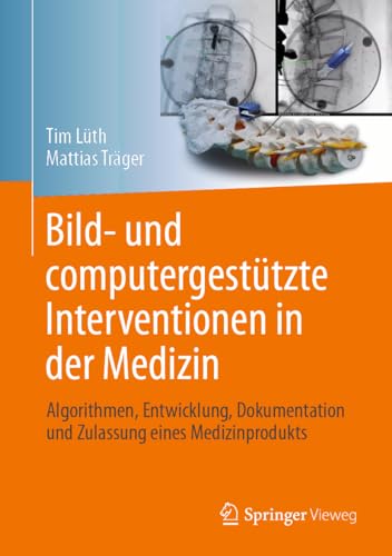 Bild- und computergestützte Interventionen in der Medizin: Algorithmen, Entwicklung, Dokumentation und Zulassung eines Medizinprodukts von Springer Vieweg