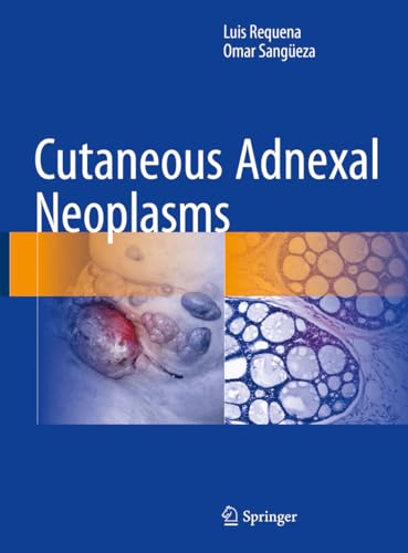 Cutaneous Adnexal Neoplasms von Springer