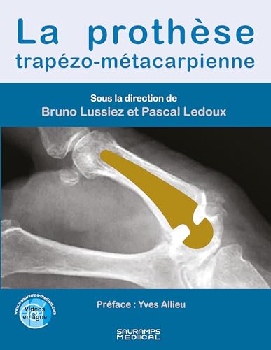 La prothèse trapézo-métacarpienne von SAURAMPS MEDICA