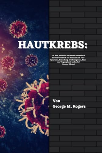 HAUTKREBS: Ein Buch, das Ihnen ein besseres Verständnis darüber vermittelt, was Hautkrebs ist, seine Symptome, Behandlung, Ernährungswahl, Tipps zum ... und mehr!(German Edition) (Streben mit Krebs) von Independently published