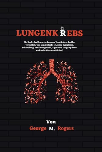 LUNGENKREBS: Ein Buch, das Ihnen ein besseres Verständnis darüber vermittelt, was Lungenkrebs ist, seine Symptome, Behandlung, Ernährungswahl, Tipps ... und mehr!(German Edition) (Streben mit Krebs) von Independently published