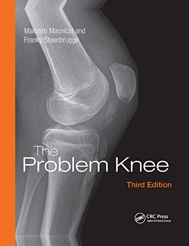 The Problem Knee von CRC Press