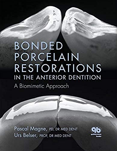 Bonded Porcelain Restorations in the Anterior Dentition: A Biomimetic Approach