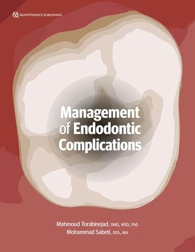 Management of Endodontic Complications: From Diagnosis to Prognosis von Quintessence Publishing