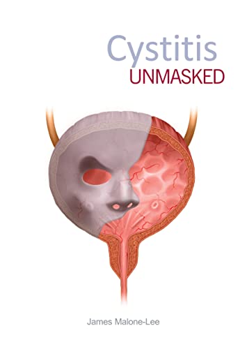 Cystitis Unmasked von Tfm Publishing