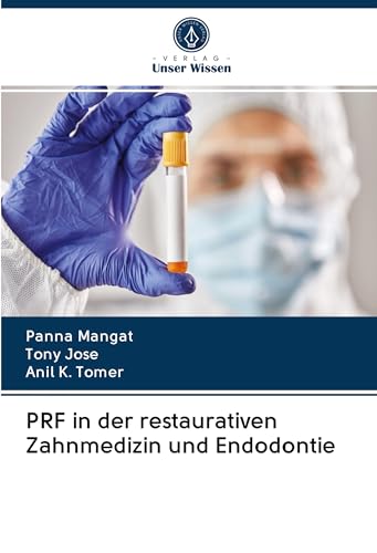 PRF in der restaurativen Zahnmedizin und Endodontie von Verlag Unser Wissen
