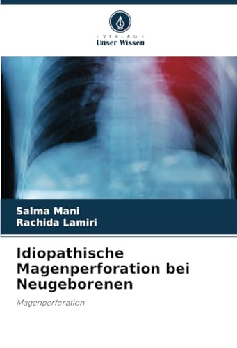 Idiopathische Magenperforation bei Neugeborenen: Magenperforation von Verlag Unser Wissen