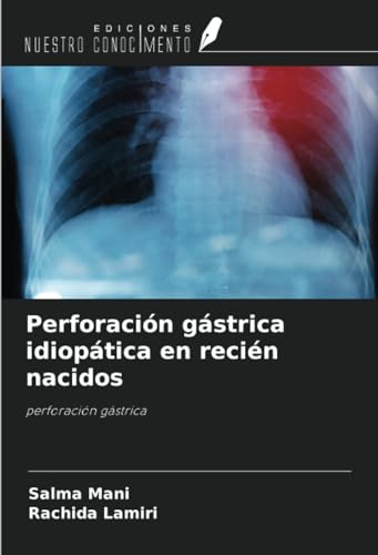 Perforación gástrica idiopática en recién nacidos: perforación gástrica von Ediciones Nuestro Conocimiento