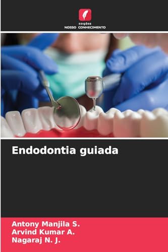 Endodontia guiada: DE von Edições Nosso Conhecimento