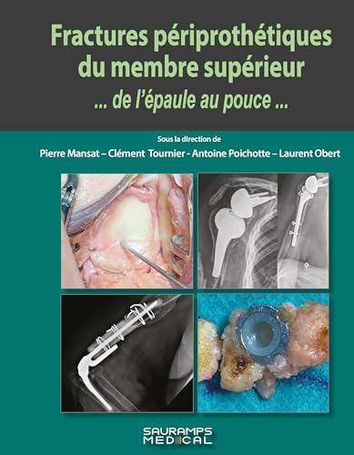 Fractures périprothétiques du membre supérieur...de l'épaule au pouce... von SAURAMPS MEDICA