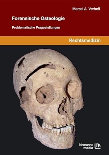 Forensische Osteologie: Problematische Fragestellungen von Lehmanns Media GmbH
