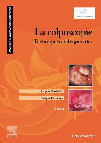 La colposcopie: Techniques et diagnostics von MASSON