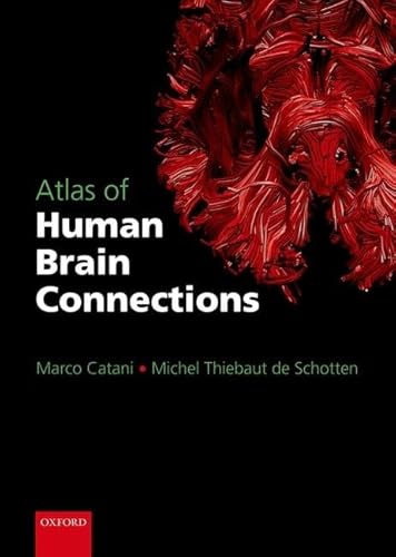 Atlas of Human Brain Connections von Oxford University Press