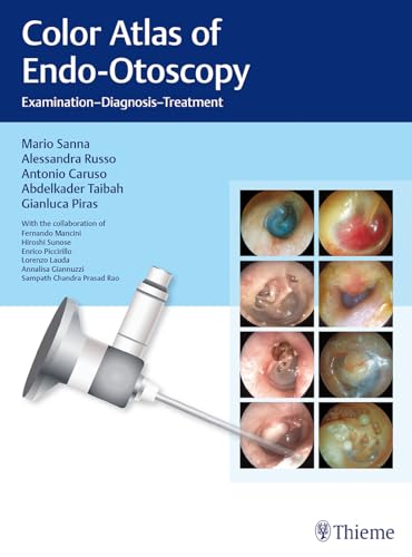 Color Atlas of Endo-Otoscopy: Examination-Diagnosis-Treatment von Georg Thieme Verlag