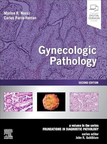 Gynecologic Pathology: A Volume in Foundations in Diagnostic Pathology Series von Elsevier