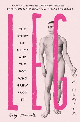 Leg: The Story of a Limb and the Boy Who Grew from It von Trapeze