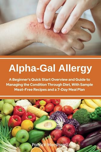 Alpha-Gal Allergy: A Beginner's Quick Start Overview and Guide to Managing the Condition Through Diet, with Sample Meat-Free Recipes and a 7-Day Meal Plan von Independently published