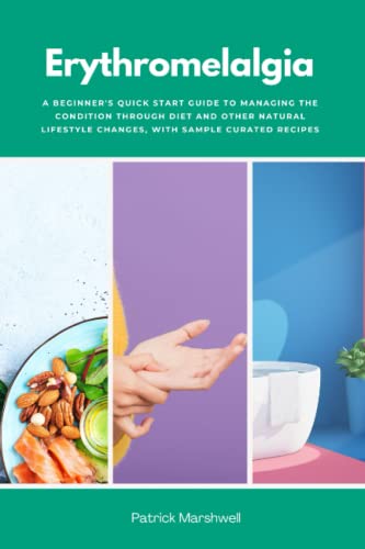 Erythromelalgia: A Beginner's Quick Start Guide to Managing the Condition Through Diet and Other Natural Lifestyle Changes, With Sample Curated Recipes von Independently published