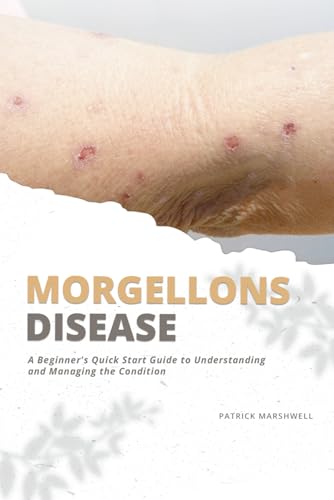 Morgellons Disease: A Beginner's Quick Start Guide to Understanding and Managing the Condition von Independently published