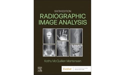 Radiographic Image Analysis von Saunders