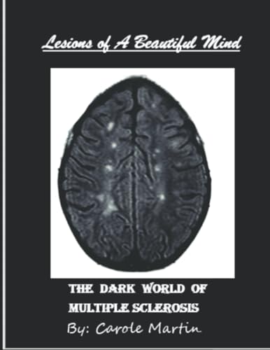 Lesions of a Beautiful Mind: The Dark World of Multiple Sclerosis von Independently published