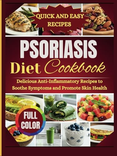 Psoriasis Diet Cookbook: Delicious anti-inflammatory recipe to soothe symptoms and promote skin health von Independently published