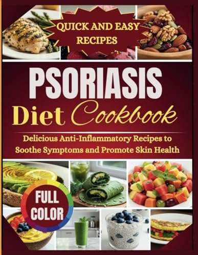 Psoriasis Diet Cookbook: Delicious anti-inflammatory recipe to soothe symptoms and promote skin health von Independently published