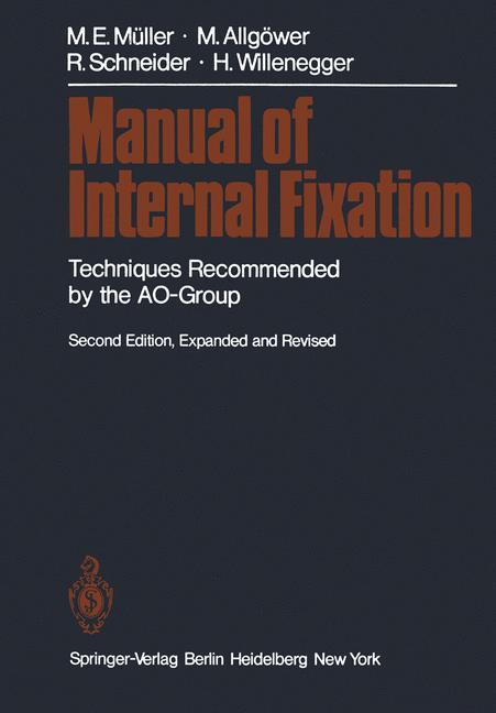 Manual of Internal Fixation von Springer Berlin Heidelberg