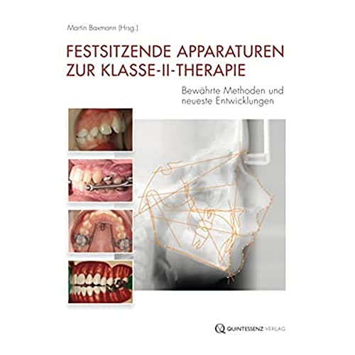 Festsitzende Apparaturen zur Klasse-II-Therapie: Bewährte Methoden und neueste Entwicklungen von Quintessenz Verlag