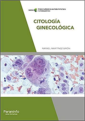 Citología ginecológica von Ediciones Paraninfo, S.A
