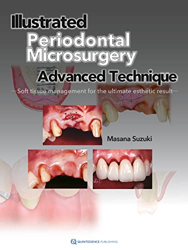 Illustrated Advanced Technique of Periodontal Microsurgery: Soft tissue management for the ultimate esthetic result: Advanced Technique Soft Tissue Management for the Ultimate Esthetic Result von Quintessence Publishing