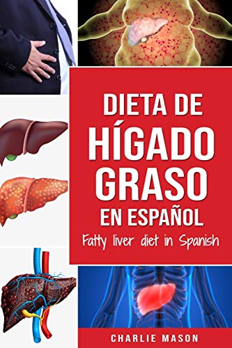 Dieta de hígado graso en español/Fatty liver diet in Spanish Dieta de hígado graso en español/Fatty liver diet in Spanish