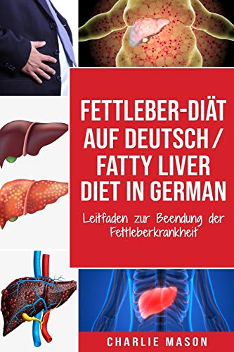 Fettleber-Diät Auf Deutsch/ Fatty liver diet In German: Leitfaden zur Beendung der Fettleberkrankheit