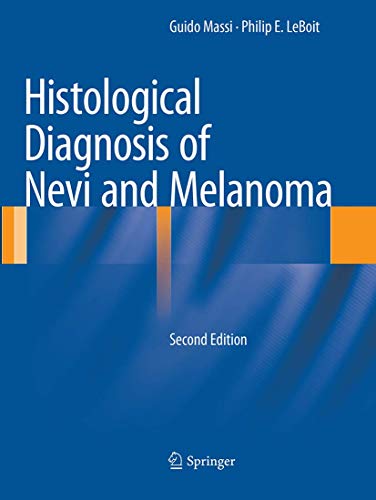 Histological Diagnosis of Nevi and Melanoma von Springer