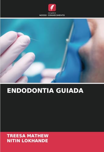 ENDODONTIA GUIADA: DE von Edições Nosso Conhecimento