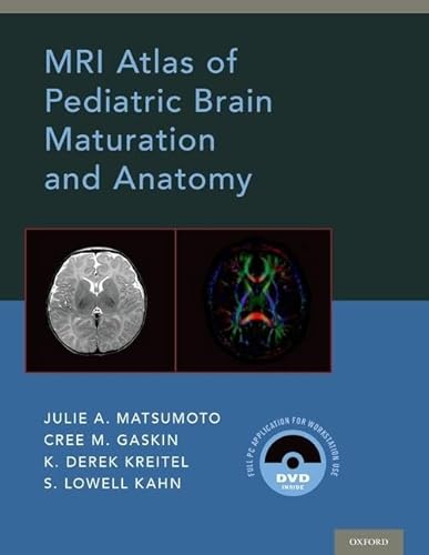 MRI Atlas of Pediatric Brain Maturation and Anatomy von Oxford University Press, USA