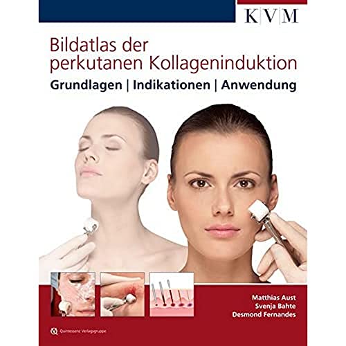 Bildatlas der perkutanen Kollageninduktion: Grundlagen | Indikationen | Anwendung Bildatlas der perkutanen Kollageninduktion: Grundlagen | Indikationen | Anwendung