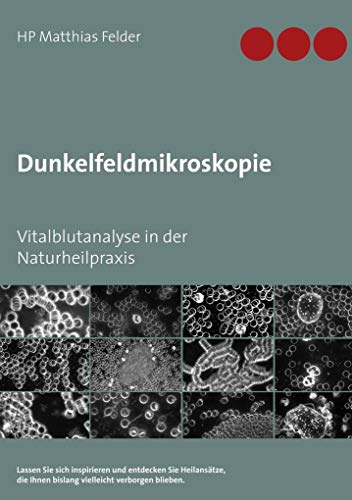 Dunkelfeldmikroskopie: Vitalblutanalyse in der Naturheilpraxis von Books on Demand GmbH