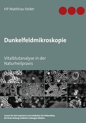 Dunkelfeldmikroskopie: Vitalblutanalyse in der Naturheilpraxis von Books on Demand GmbH