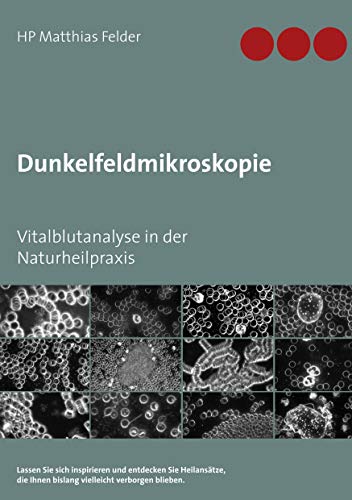 Dunkelfeldmikroskopie: Vitalblutanalyse in der Naturheilpraxis