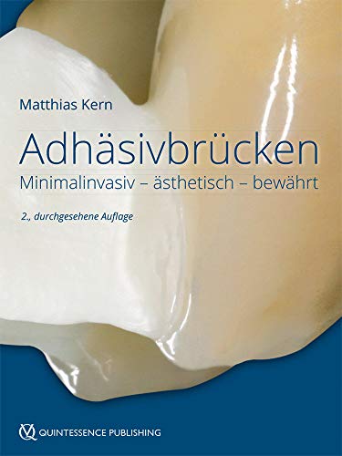 Adhäsivbrücken: Minimalinvasiv - ästhetisch - bewährt von Quintessenz Verlags-GmbH