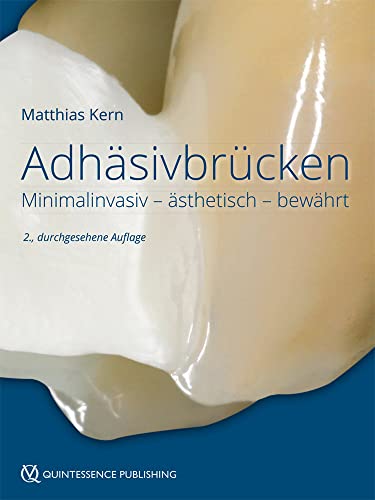 Adhäsivbrücken: Minimalinvasiv - ästhetisch - bewährt von Quintessenz Verlags-GmbH