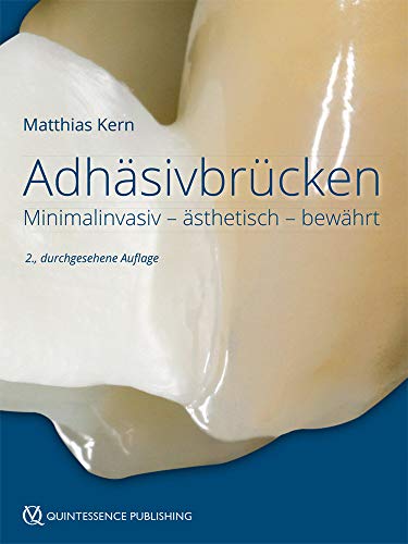 Adhäsivbrücken: Minimalinvasiv - ästhetisch - bewährt