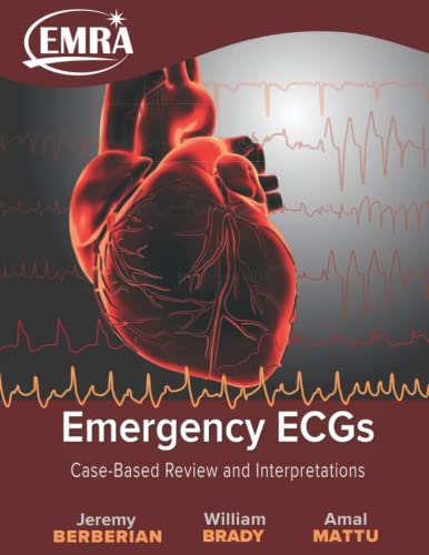 Emergency ECGs: Case-Based Review and Interpretations von Emergency Medicine Residents Association